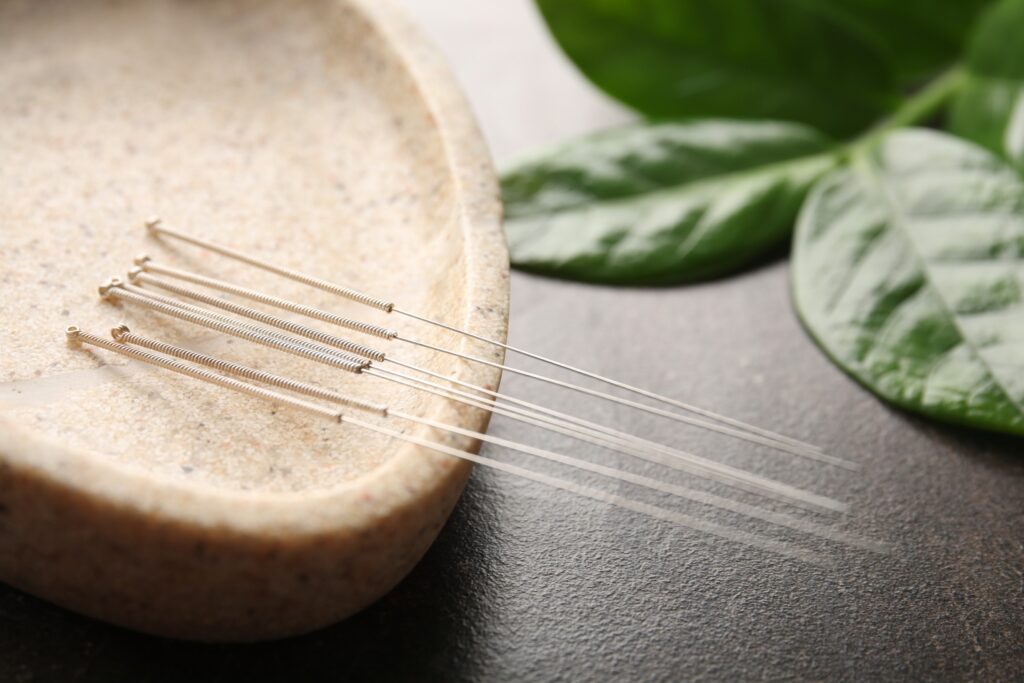 igłoterapia estetyczna, ent, akupunktura estetyczna, needles therapy, fizjoterapia estetyczna
