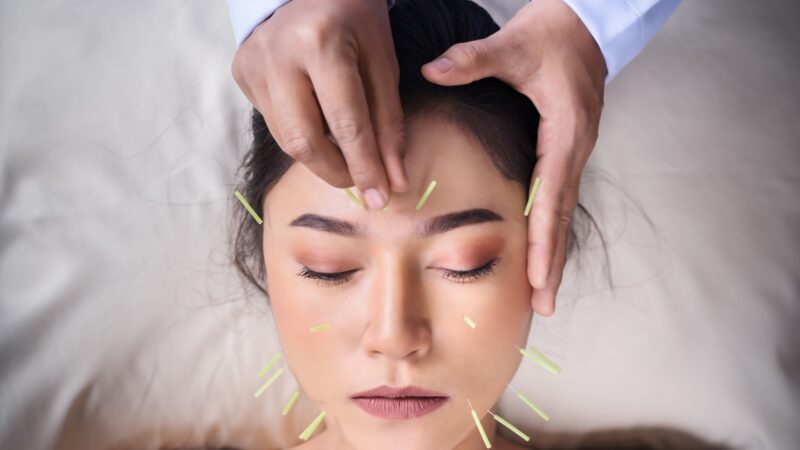 igłoterapia estetyczna, ent, akupunktura estetyczna, needles therapy,